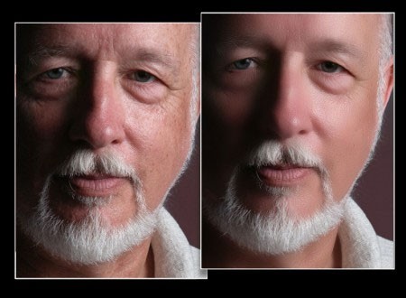 Cpac Imaging Pro 3